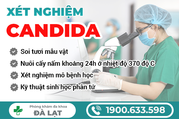 Hình ảnh minh họa